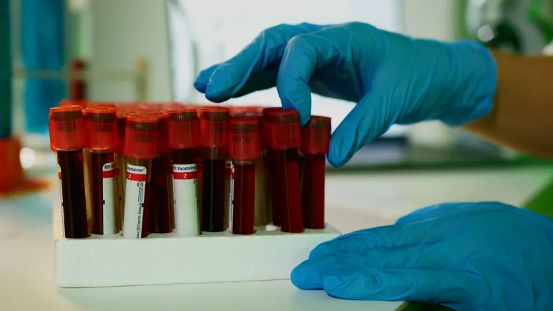 Eating Red Meat and Still Iron-Deficient: The Absorption Problem Most Women Never Hear About